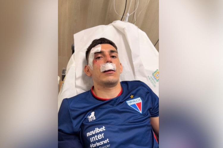 Jogador do Fortaleza tem trauma cranioencefálico após ataque da torcida do Sport