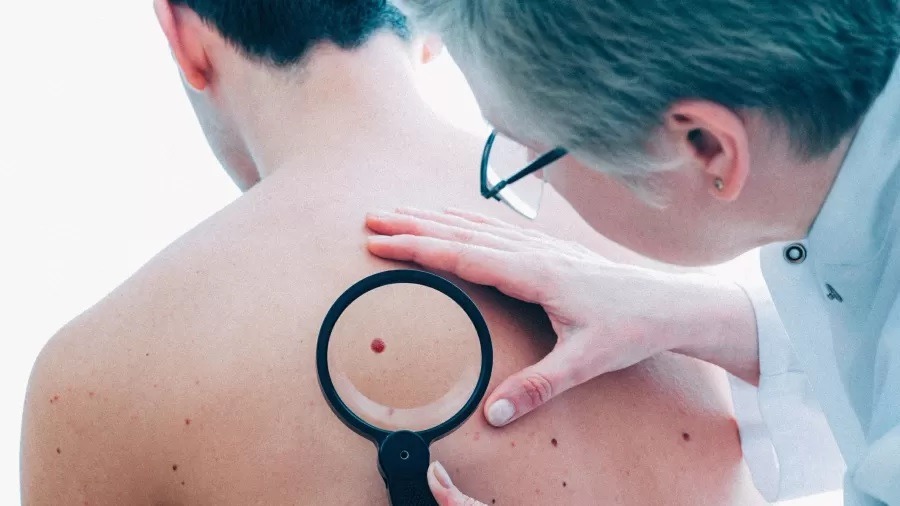 Câncer de pele: quais os tipos mais comuns e suas características?