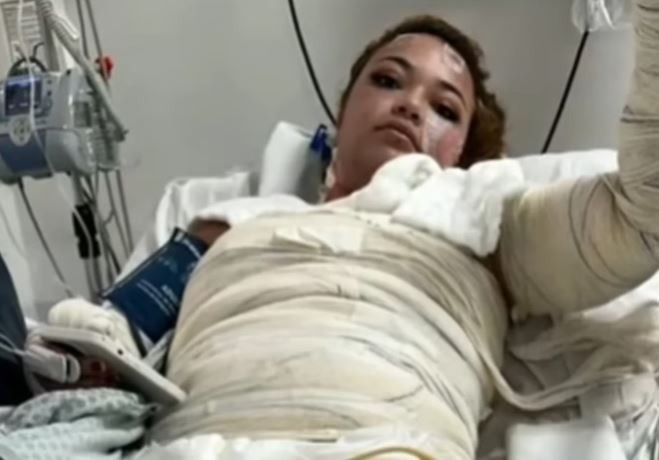 Mistério em motel: Saiba o que falta saber sobre jovem queimada e morta em quarto