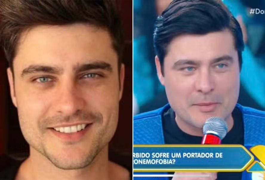 Aparência de Guilherme Leicam chama atenção na web: 'Desarmonização'