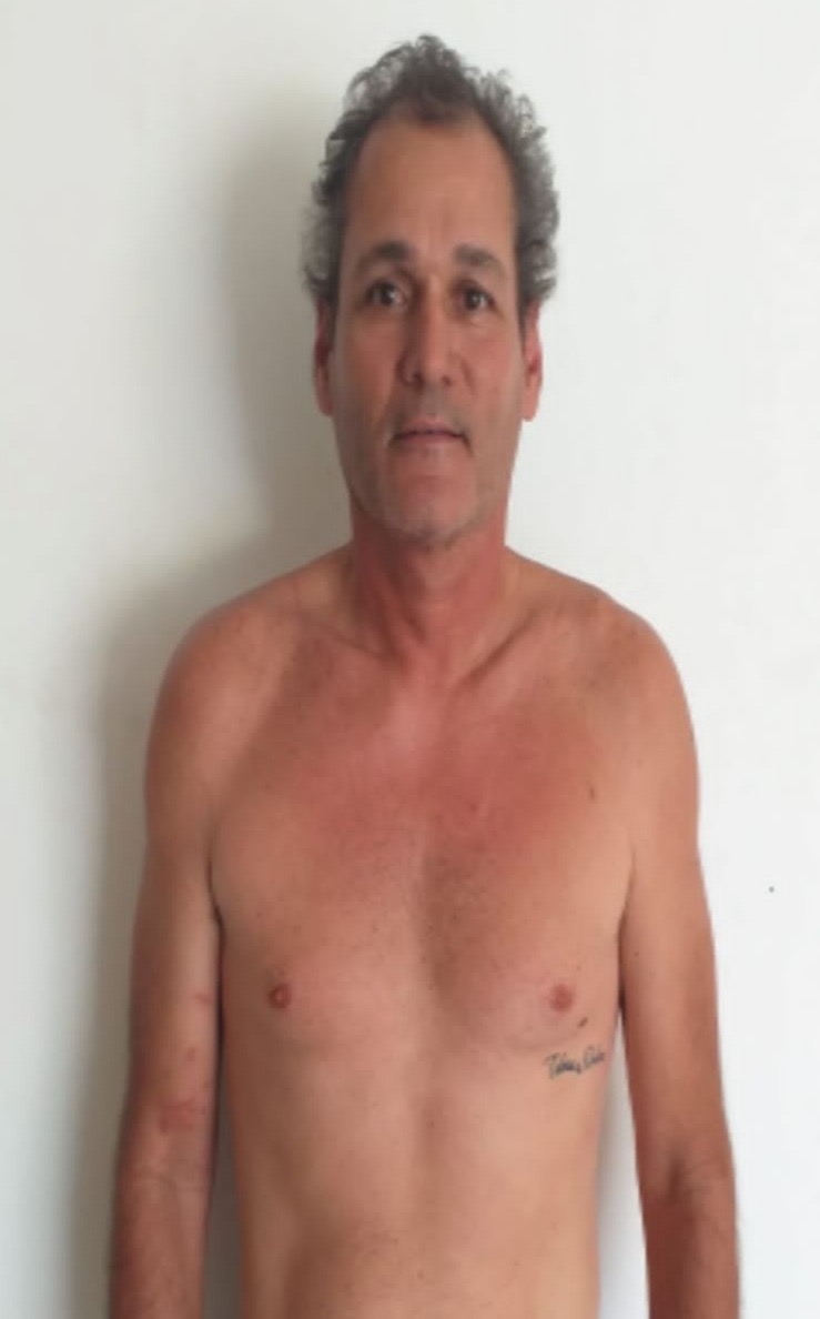 TJ mantém condenação de empresário potiguar acusado de agredir ex-miss RN