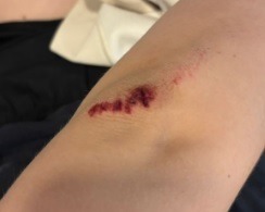 Menina que pulou de carro de app por medo de estupro: “Traumatizada”