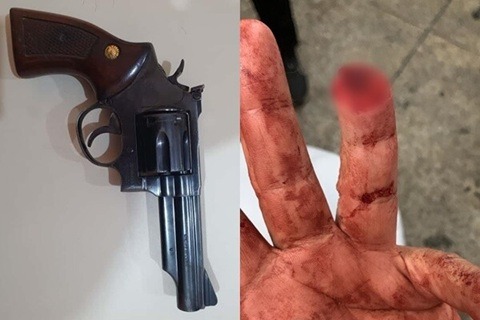 Homem é preso em Areia Branca suspeito de morder e decepar dedo de vítima