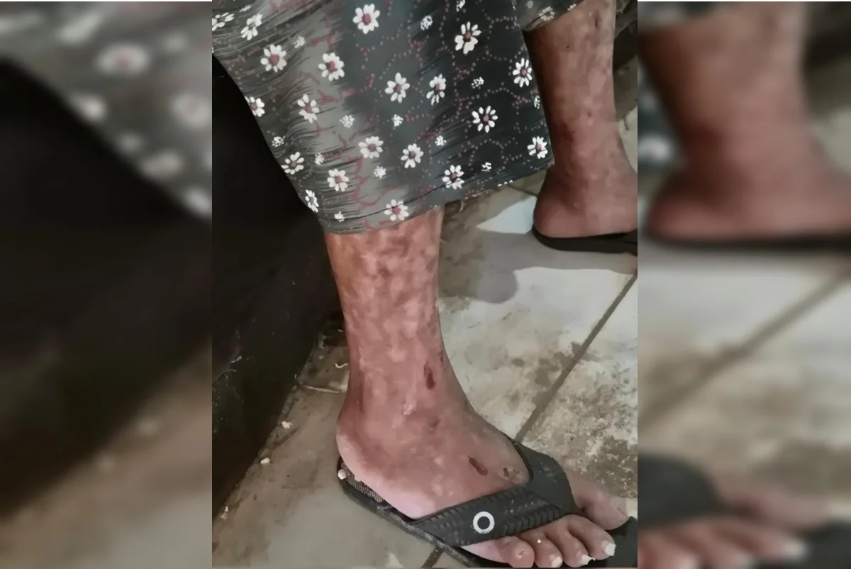 Testemunha ouviu filho que manteve mãe presa gritar: “Morre, velha”