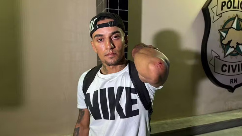 Filho de sargento denuncia ter sido agredido por militar dentro de quartel do Corpo de Bombeiros em Natal