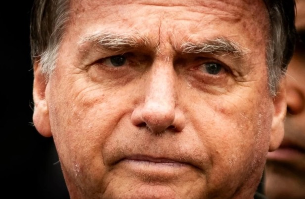 Laudo da PF confirma hérnia bilateral em Bolsonaro e necessidade de cirurgia urgente