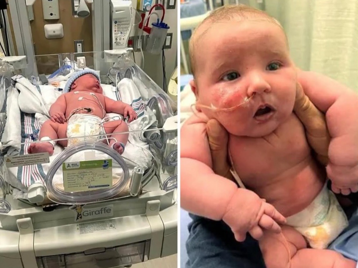Bebê nasce com mais de 7kg e surpreende família