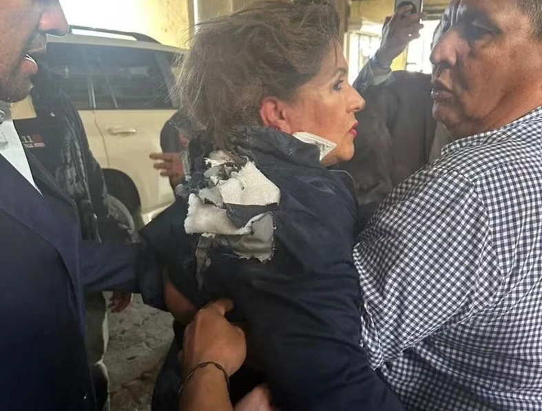 VÍDEO: Deputada é atingida na cabeça por explosivo durante entrevista em Honduras