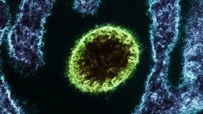 Com alta taxa de mortalidade, vírus Nipah mantém países em alerta após casos na Índia
