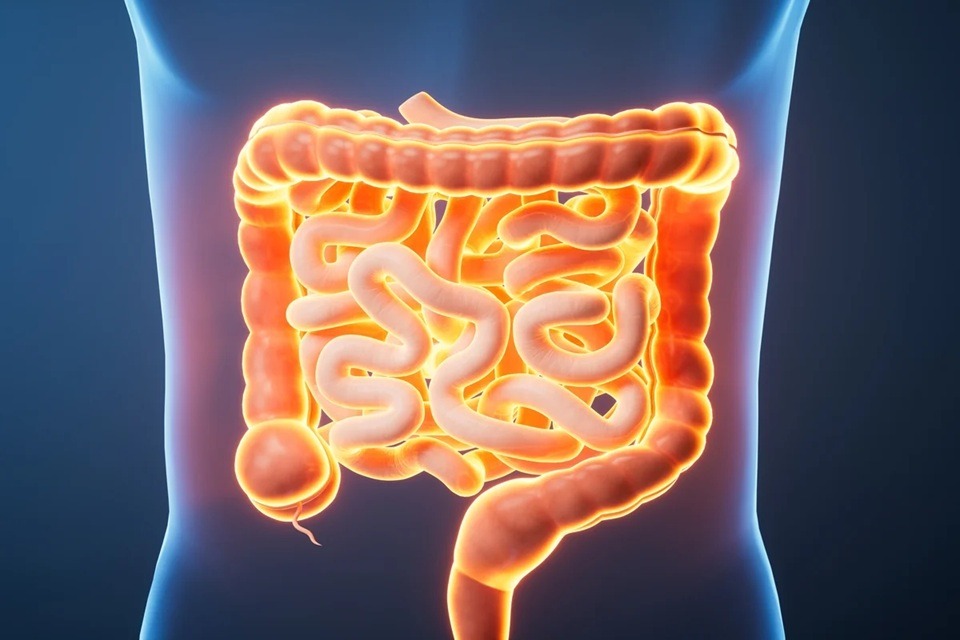 Médica revela 6 alimentos que podem prejudicar a saúde do intestino