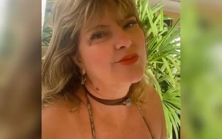 Mãe de vereador morre após procedimento com PMMA