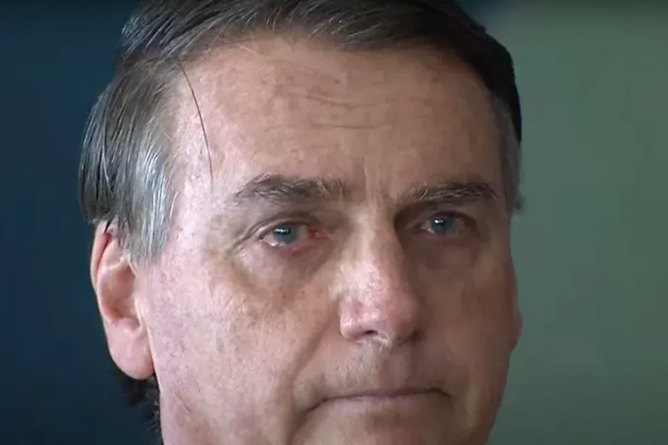 Bolsonaro volta a ter crises intensas de soluços e alteração na pressão arterial