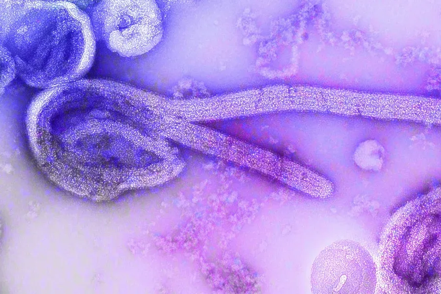 Surto de ebola pode chegar ao Brasil? Saiba o que dizem especialistas