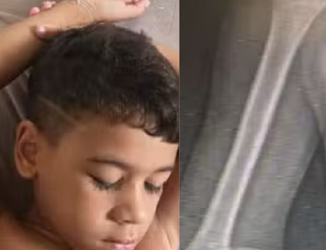 Menino de 6 anos descobre câncer raro após fortes dores no braço