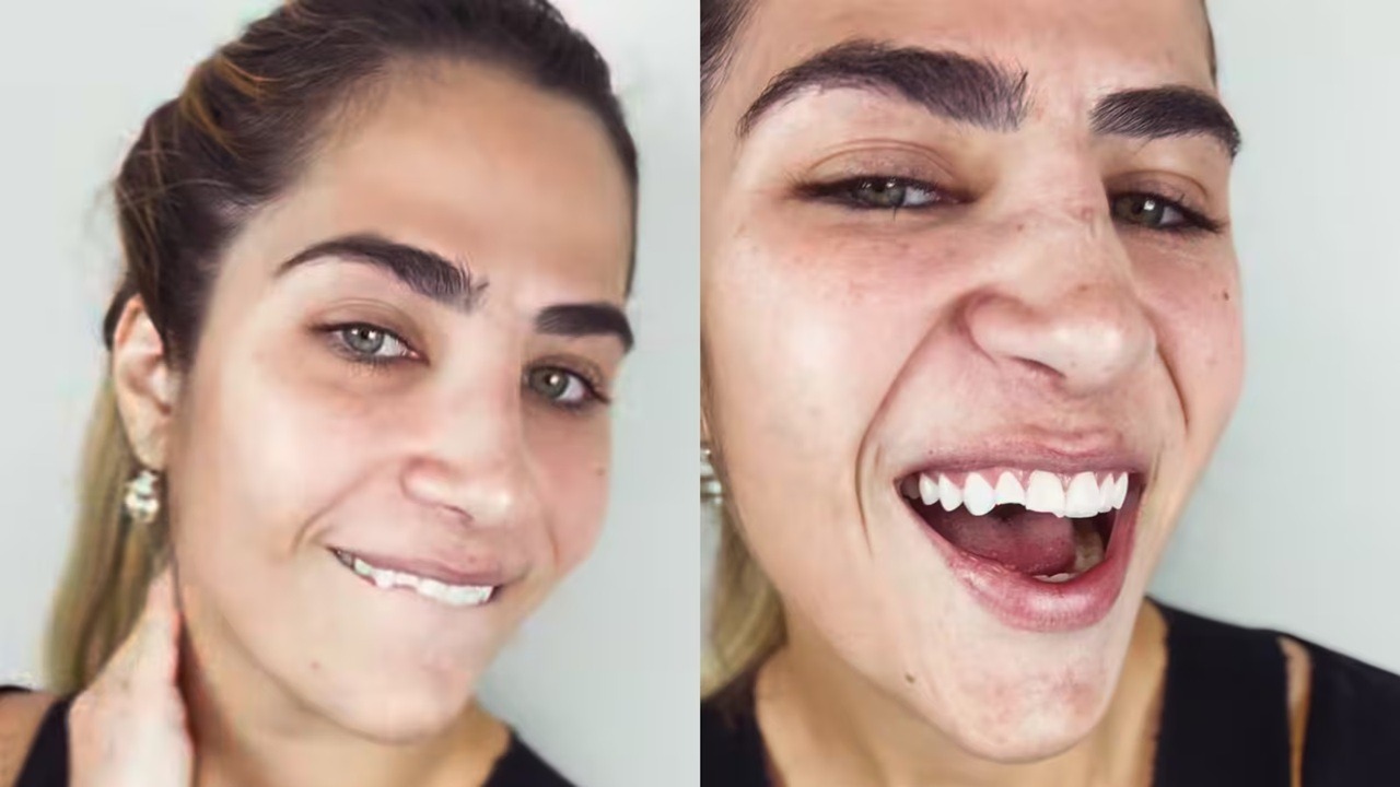 Filha de Leonardo quebra os dentes após noite romântica e revela detalhe inusitado