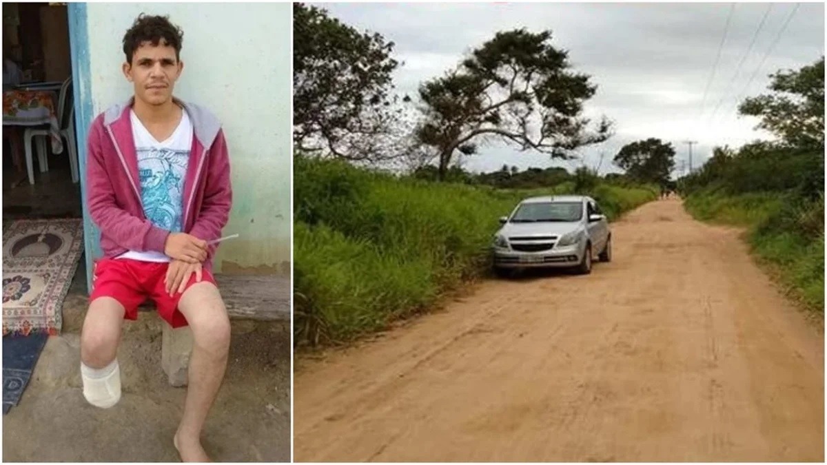 Plano chocante: servidor amputa a própria perna para aplicar golpe de R$ 1,5 milhão