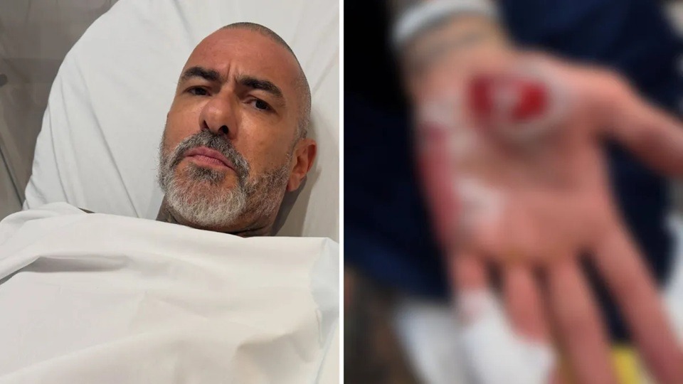 Apresentador do MasterChef sofre acidente de moto e denuncia roubo de aliança em hospital