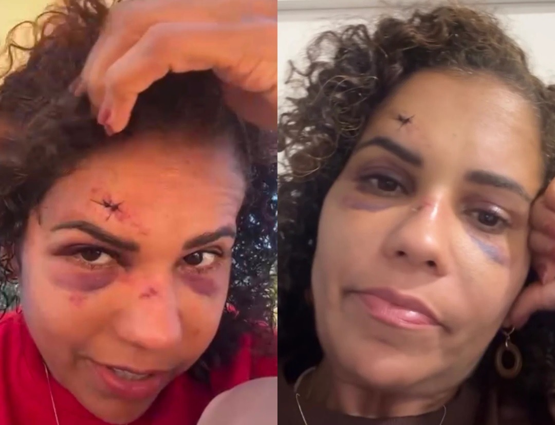 Turista sofre tentativa de estupro e é atacada com pedradas durante caminhada em praia de Touros, no RN