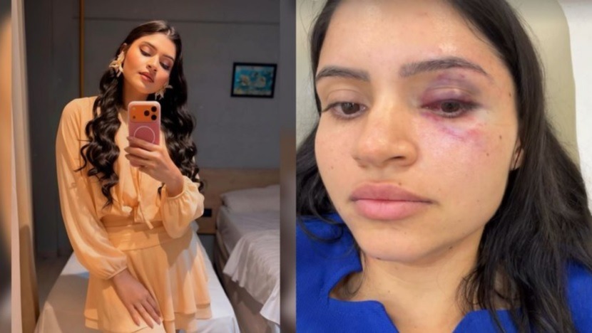 “Cheguei a desmaiar”: técnica de enfermagem é enforcada e agredida pelo marido na Grande Natal