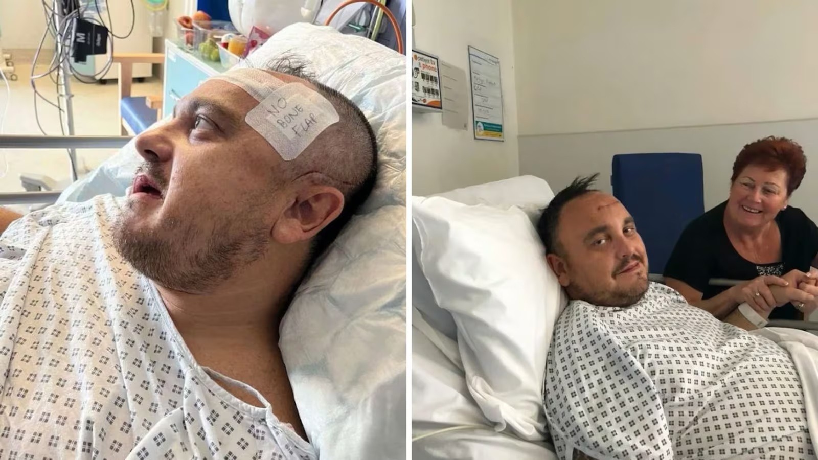 Homem faz tratamento por ‘sorriso perfeito’, tem infecção cerebral e quase morre