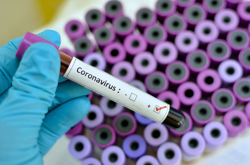Coronavírus: saiba quando ir a uma unidade hospitalar