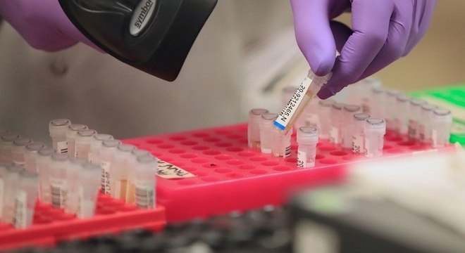 SP tem mais 4 mortes em investigação sob suspeita de coronavírus