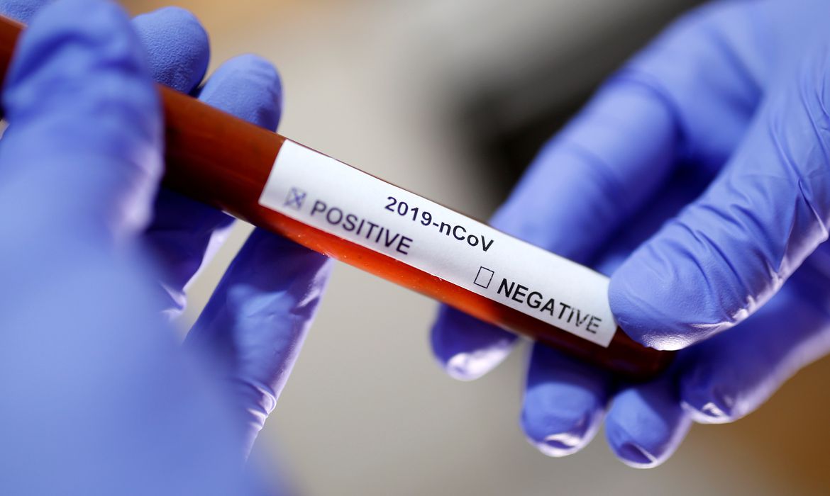 Brasil ultrapassa 2 mil casos confirmados de coronavírus; confira os números