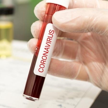Em 4 dias, pandemia avança e 12 estados já registram mortes por coronavírus