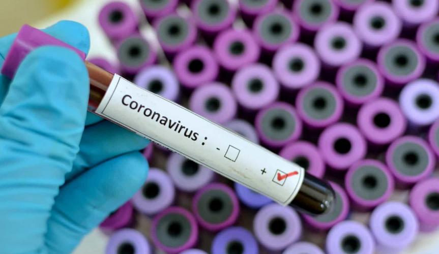 Com coronavírus, bebê de três meses morre no Ceará