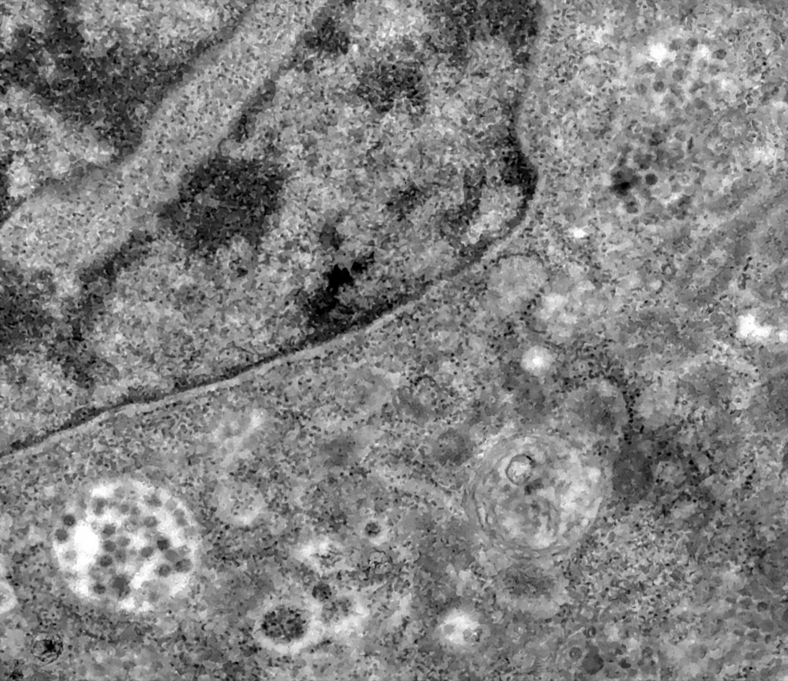Antiviral em teste detém avanço da Covid-19 em macacos