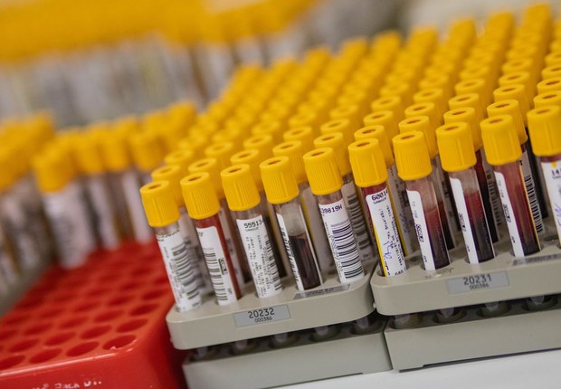 Covid-19: RN tem mais 13 casos e total de infectados é de 608; 161 estão curados