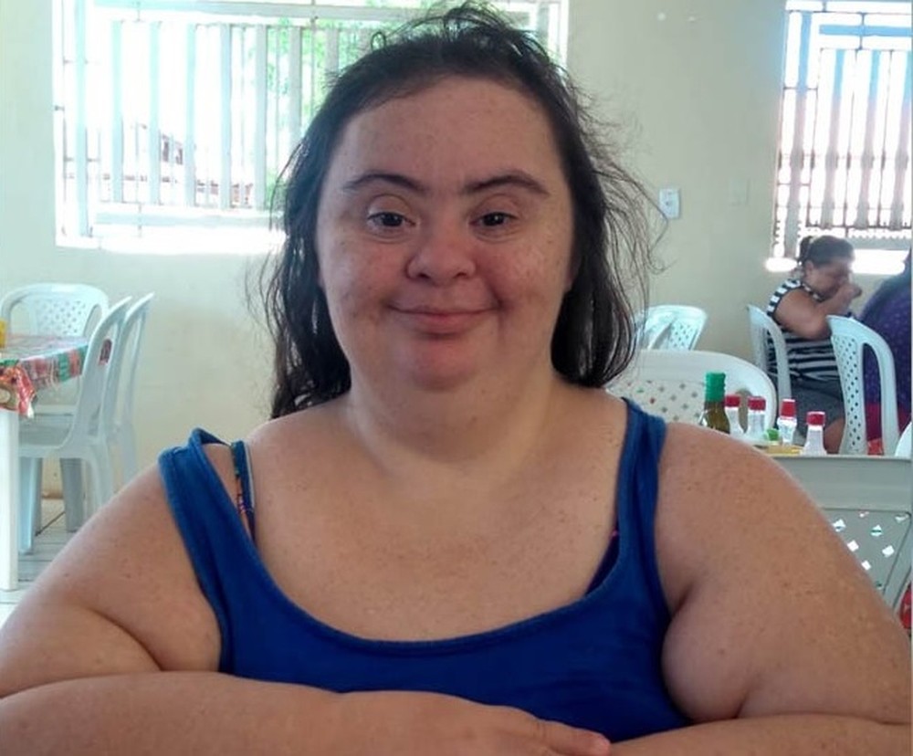 Mulher de 42 anos com síndrome de down é 39ª morte por coronavírus no RN