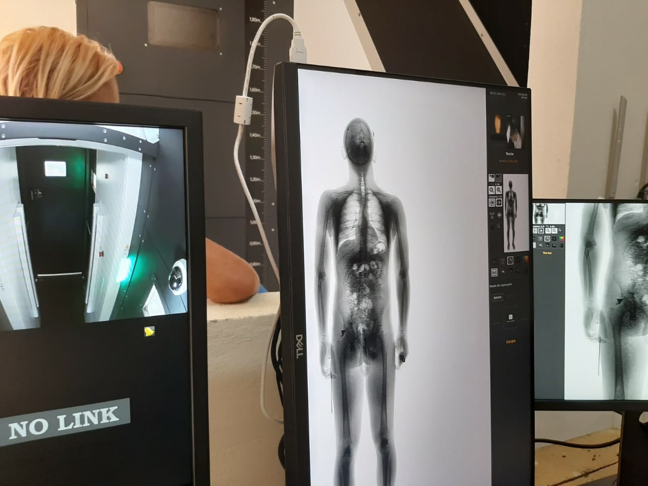 Governo Bolsonaro destina aparelhos de scanner corporal para 8 presídios do RN