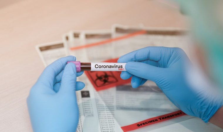 Coronavírus: Brasil tem 449 mortes confirmadas em 24 h; veja dados atualizados