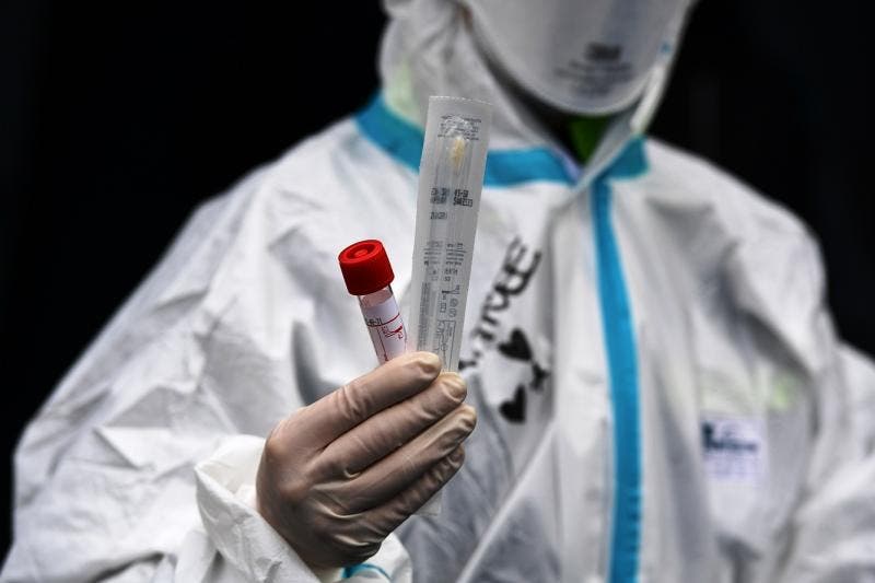 Brasil ultrapassa 100 mil casos confirmados de covid-19