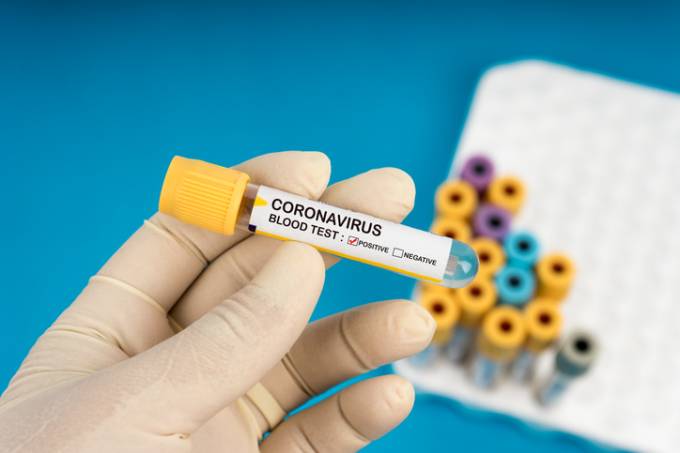 RN tem 1.421 casos confirmados e 62 óbitos por coronavírus; confira dados atuais
