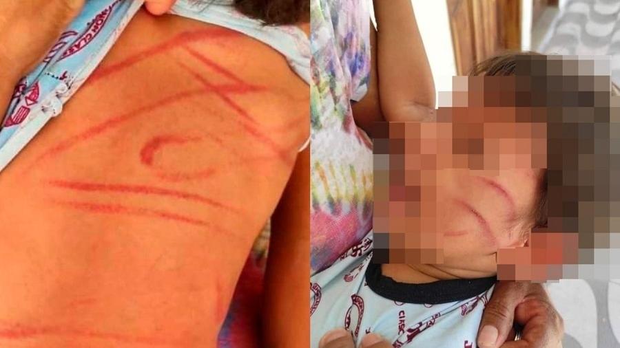 Mulher é presa por chicotear menino de 2 anos que danificou capa de celular