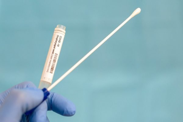Sesap: RN tem 28,5 mil testes para covid-19 com validade até o fim do ano