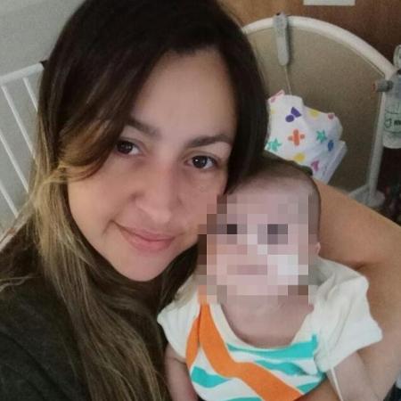 Bebê nasce com terceiro braço, metade do coração e passa por 5 cirurgias