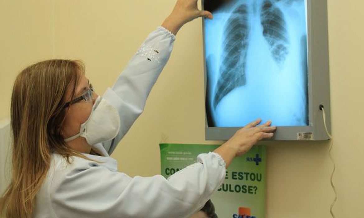 Pesquisadores do Brics buscam interconexões entre tuberculose e covid-19