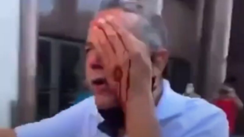 Tiro de bala de borracha da PM em protesto deixa homem cego no Recife
