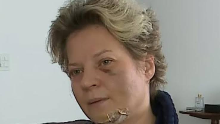 Deputada nega ter sido agredida pelo marido: “É mais fácil eu dar uma sova nele”