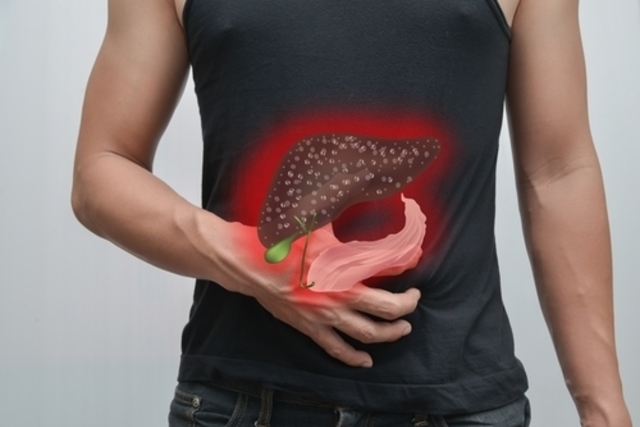 5 sinais de gordura no fígado para você ficar atento