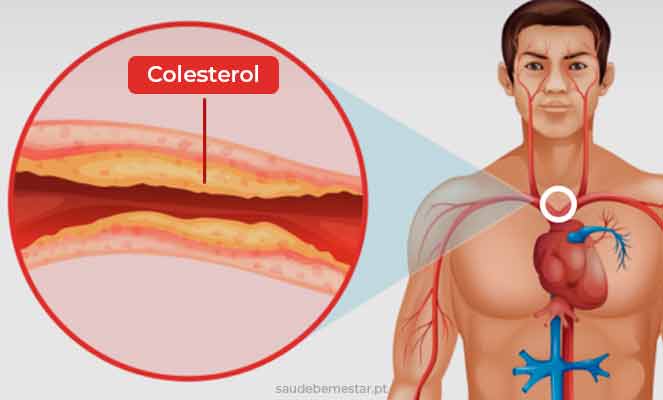 O que você precisa saber sobre o colesterol