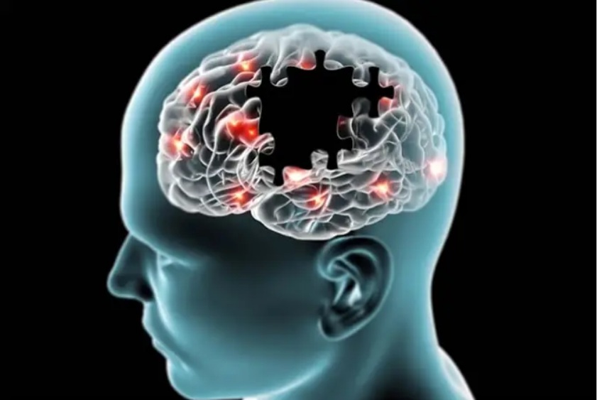 Veja 8 sinais iniciais de Alzheimer para ficar atento
