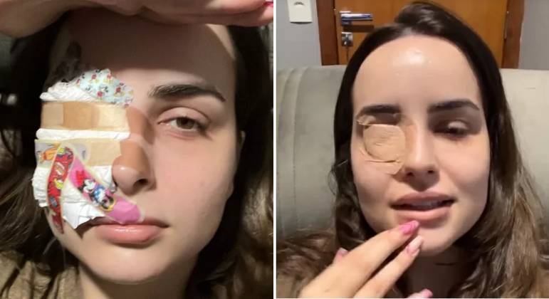 Influenciadora rasga parte da córnea ao coçar os olhos com as unhas grandes