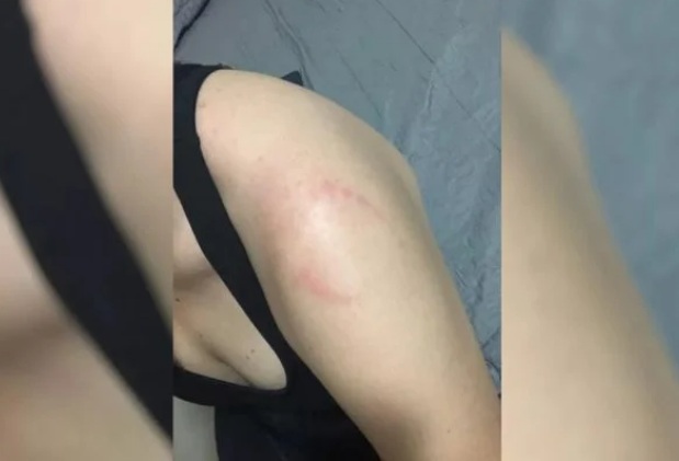 VÍDEO: Mulher leva mordida após esbarrar em homem na academia