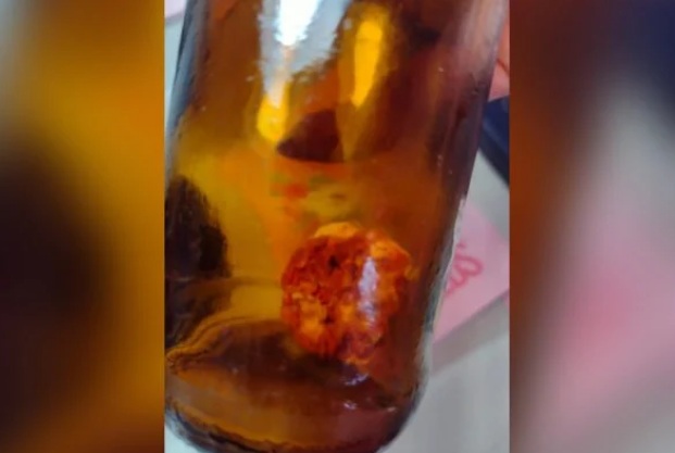 Homem diz ter encontrado um “dedo” dentro de cerveja