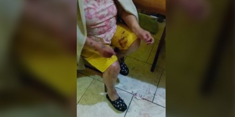 Idosa de 91 anos é torturada por criminosos durante assalto em São Paulo
