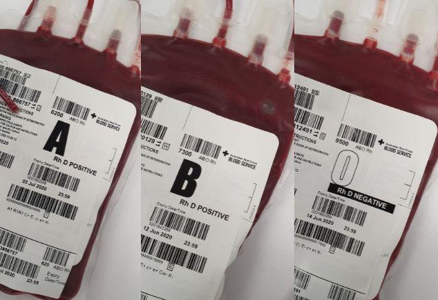 Após 40 anos, cientistas descobrem um novo tipo de sangue humano